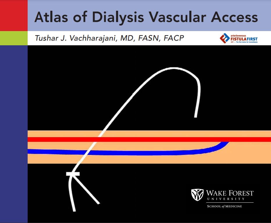 Atlas of Dialysis Vascular Access